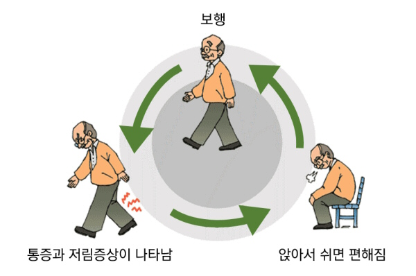 간헐적파행_600.jpg