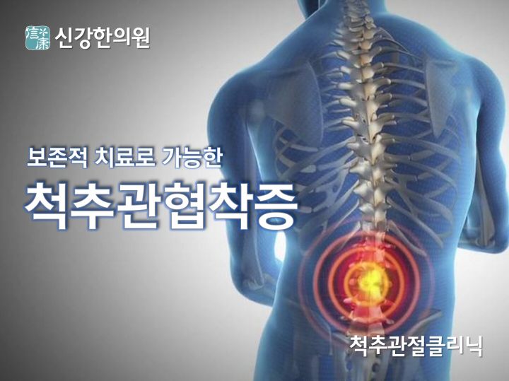 척추관협착증_타이틀_720.jpg